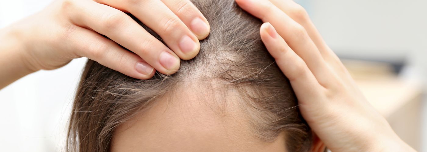 Rasare i capelli per fare il trapianto: è necessario?